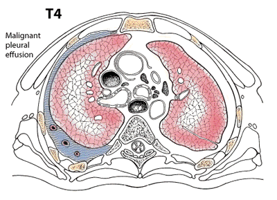 T4