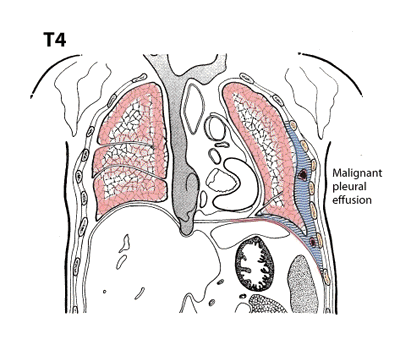 T4