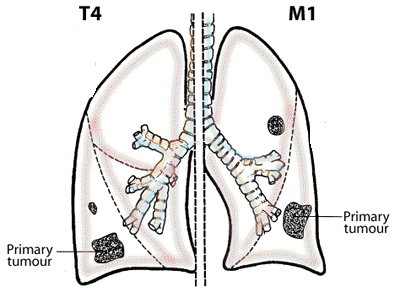 T4/M1