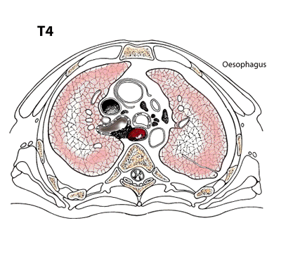 T4