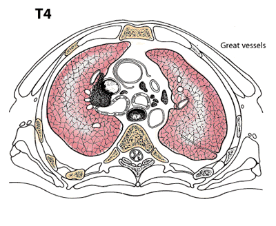 T4