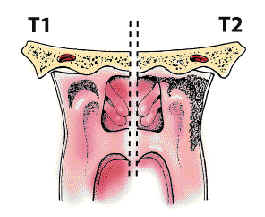 T1/T2