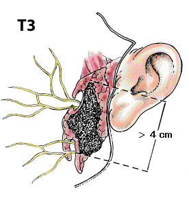 T3