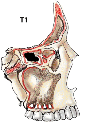 T1