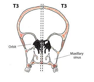 T3