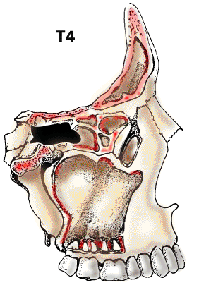 T4