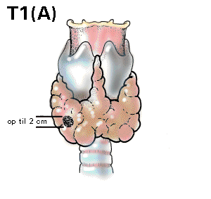 T1a