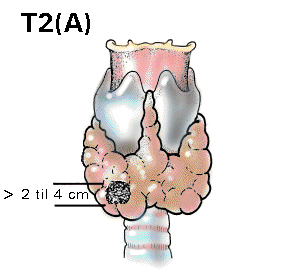 T2a