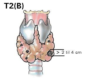 T2b