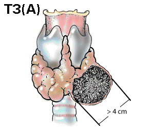 T3a