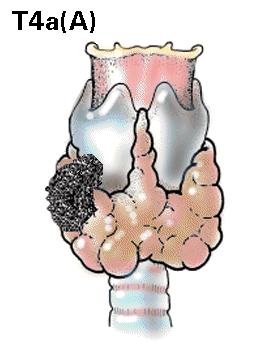 Thyroid4a.GIF (27288 bytes)