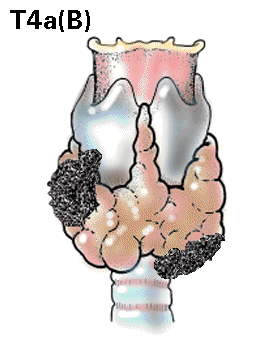 Thyroid4b.GIF (27781 bytes)