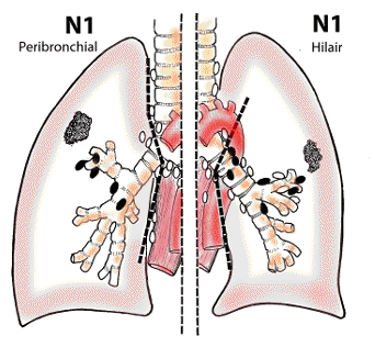 N1