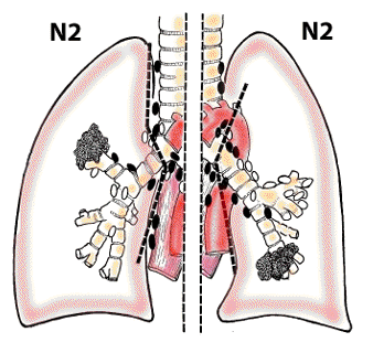 N2