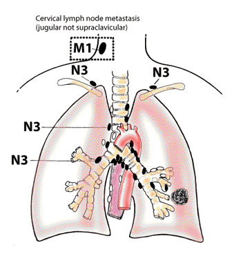 N3