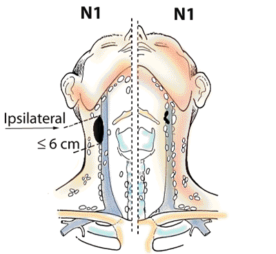 N1