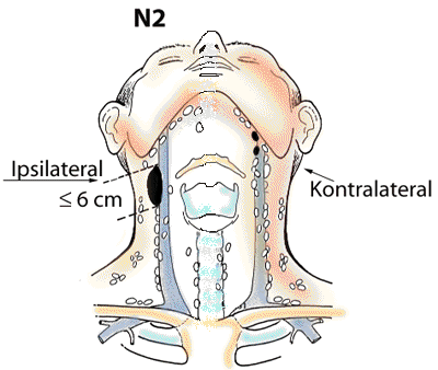 N2